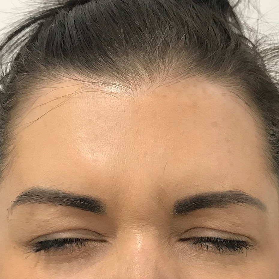 Close Up of a Woman’s Forehead