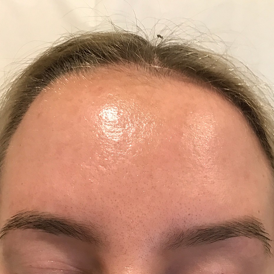 Close Up of a Woman’s Forehead