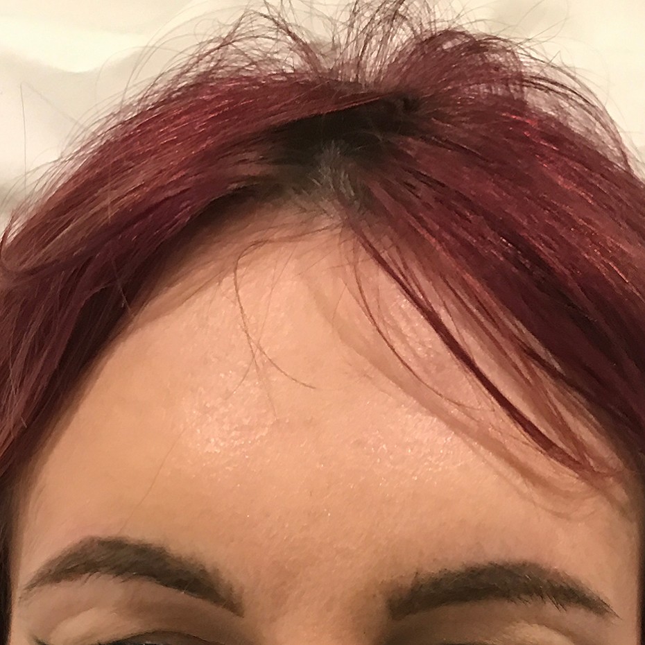 Close Up of a Woman’s Forehead