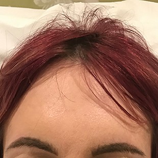 Close Up of a Woman’s Forehead