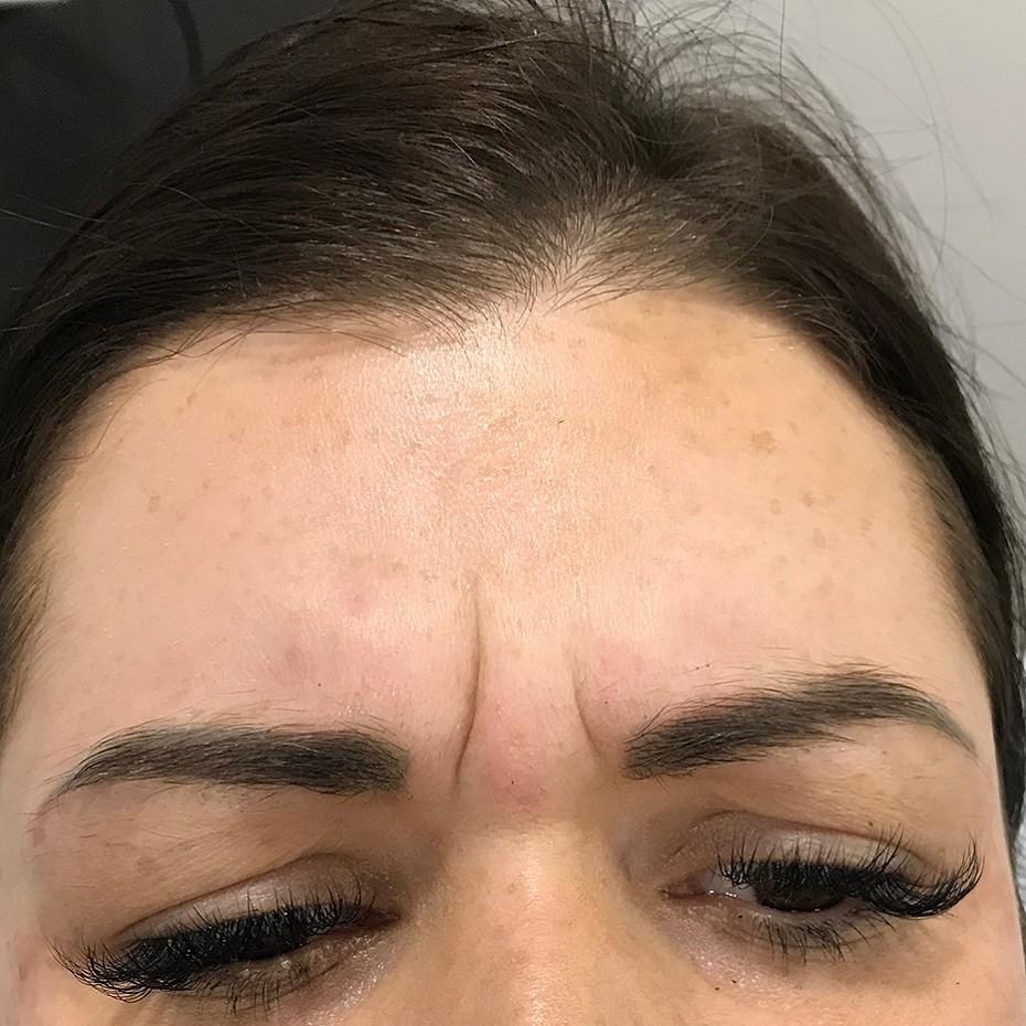 Close Up of a Woman’s Forehead