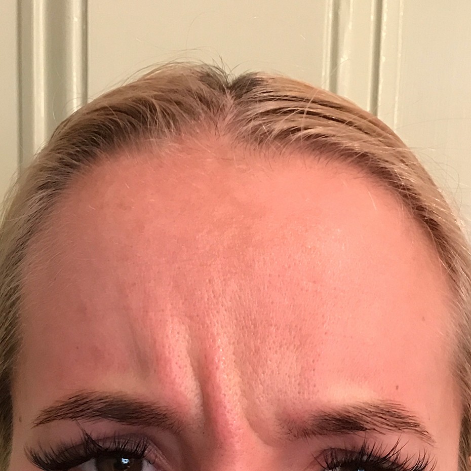 Close Up of a Woman’s Forehead