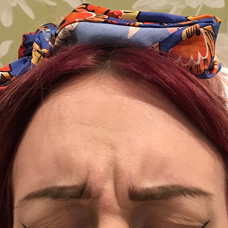 Close Up of a Woman’s Forehead