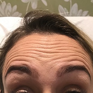 Close Up of a Woman’s Forehead