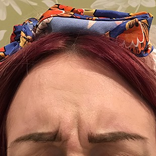 Close Up of a Woman’s Forehead