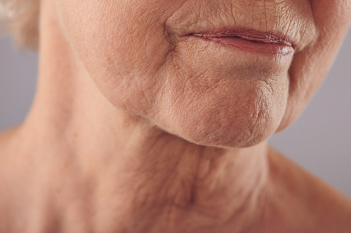 Neck wrinkles on al old ladies chin