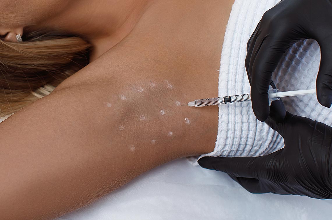 Anti-wrinkle injections being injected under a ladies arm