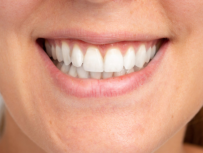 close up of ladies teeth