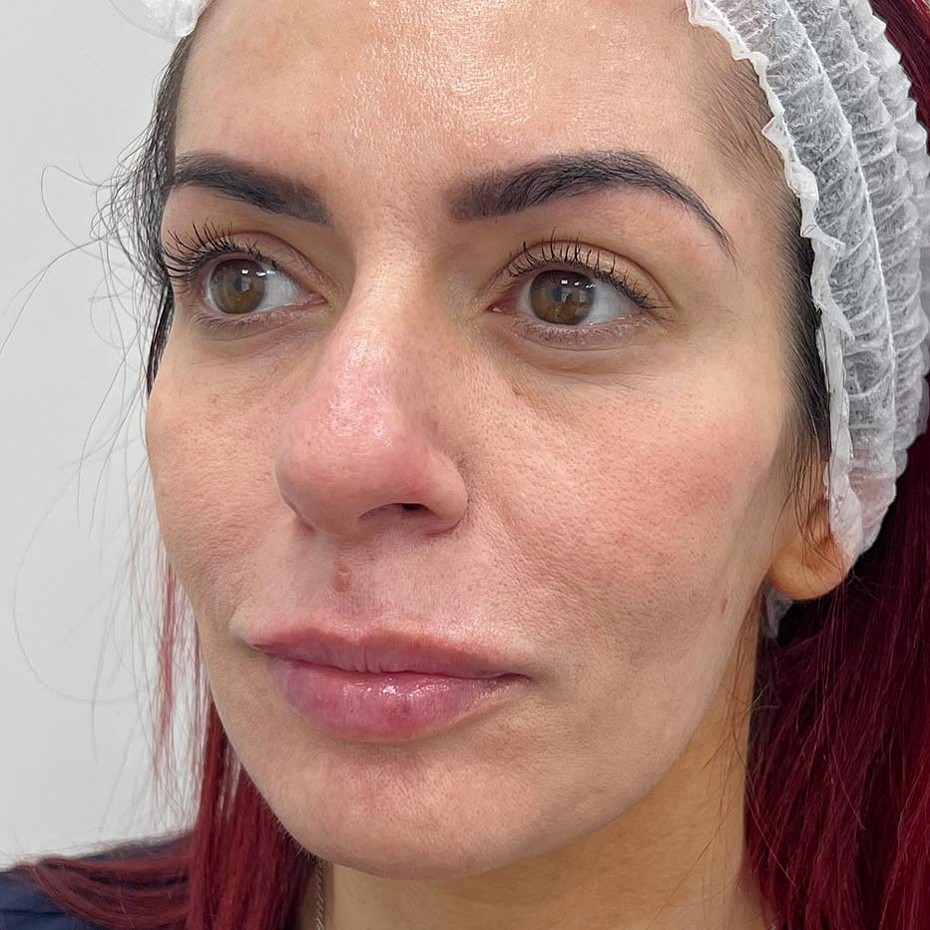 Close Up of a Woman’s Face