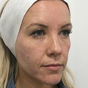 Close Up of a Woman’s Face