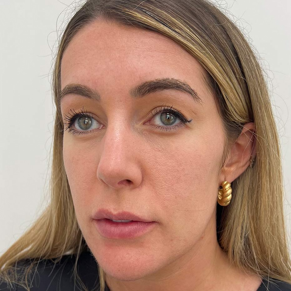 Close Up of a Woman’s Face