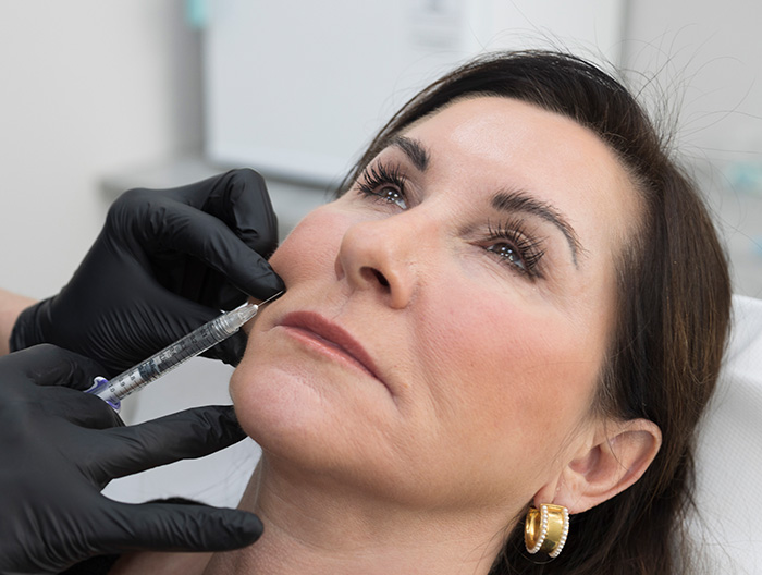 A woman having Dermal Filler treatment injections to her cheek