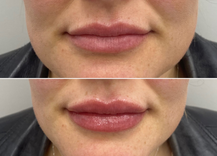 Close up of a woman’s lips