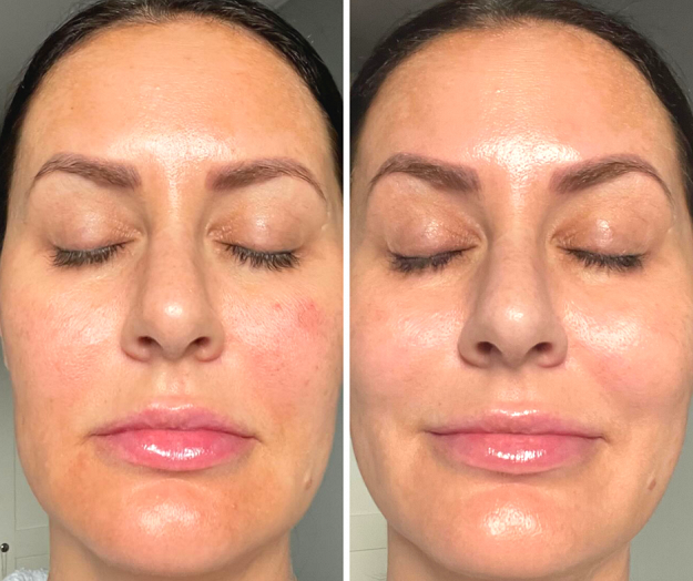 The Perfect Peel™ Product Range