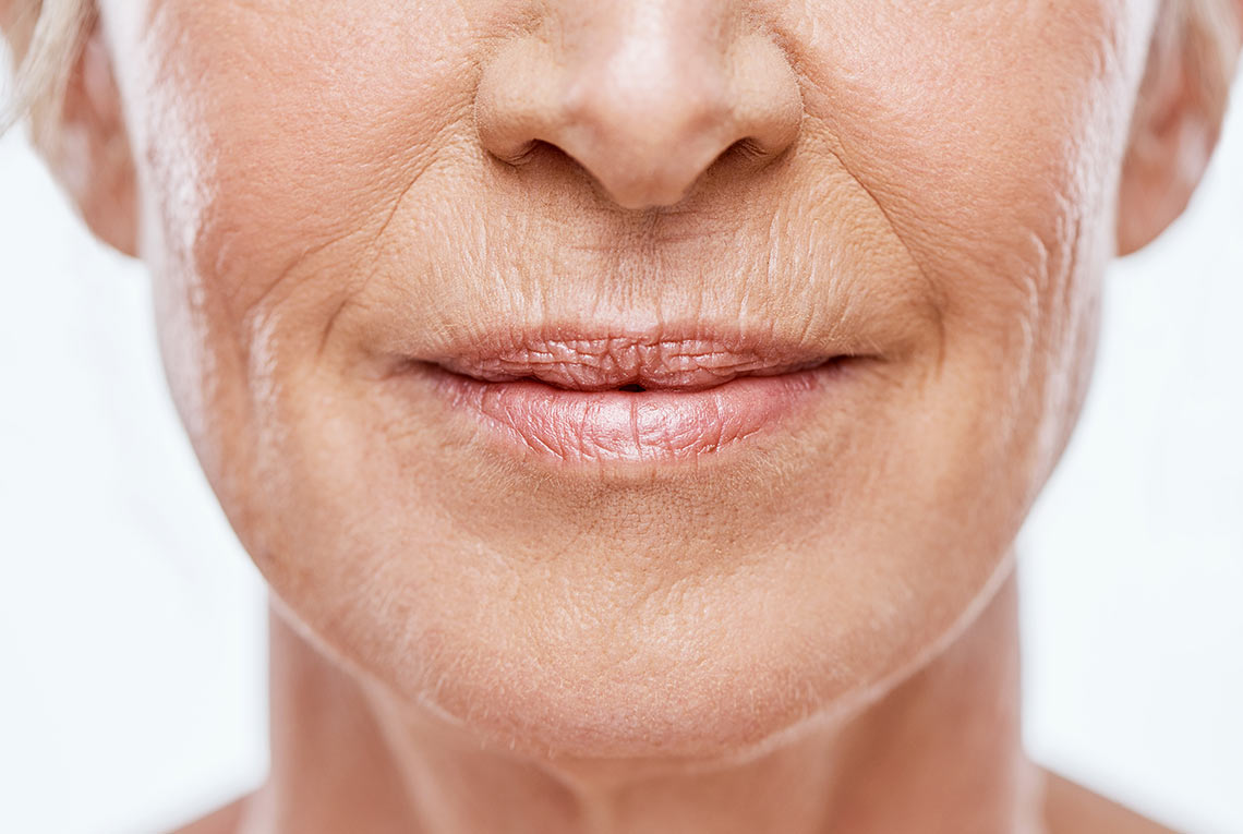 Close Up of a ladies sagging chin